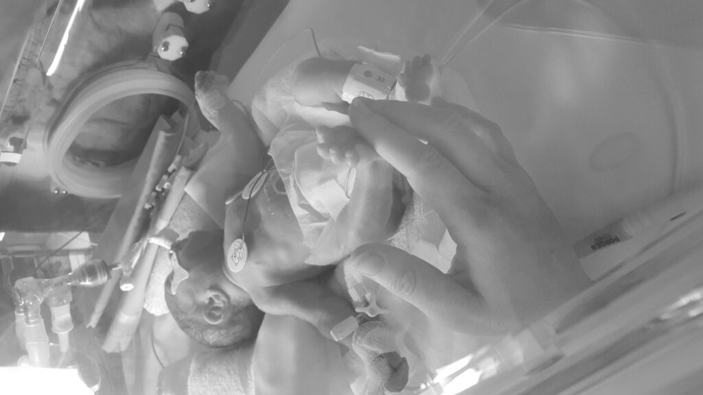 bebes cir prematuros