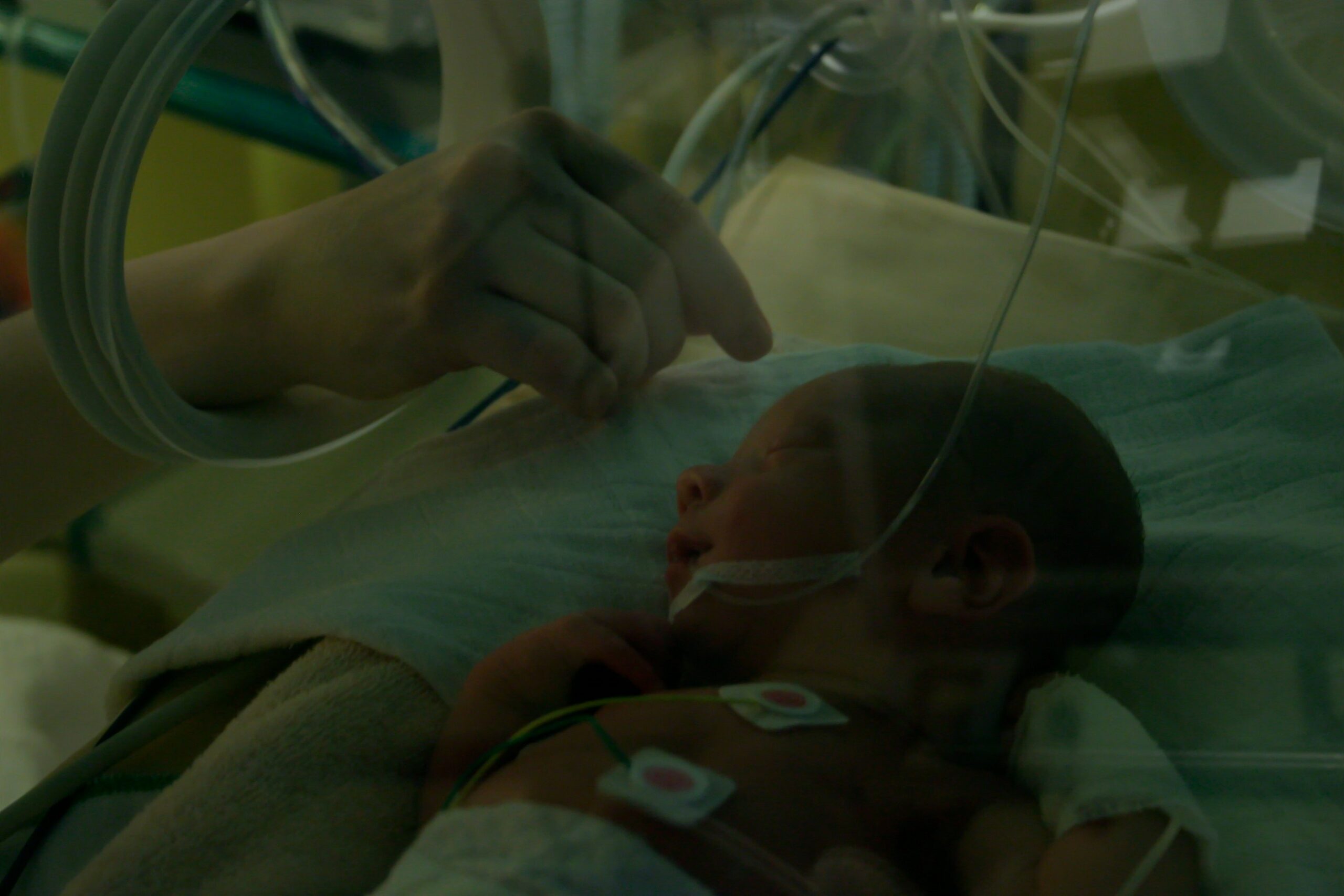 cuatro tipos de prematuros