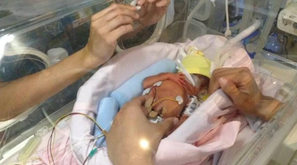 ayudas por nacimiento de un hijo prematuro